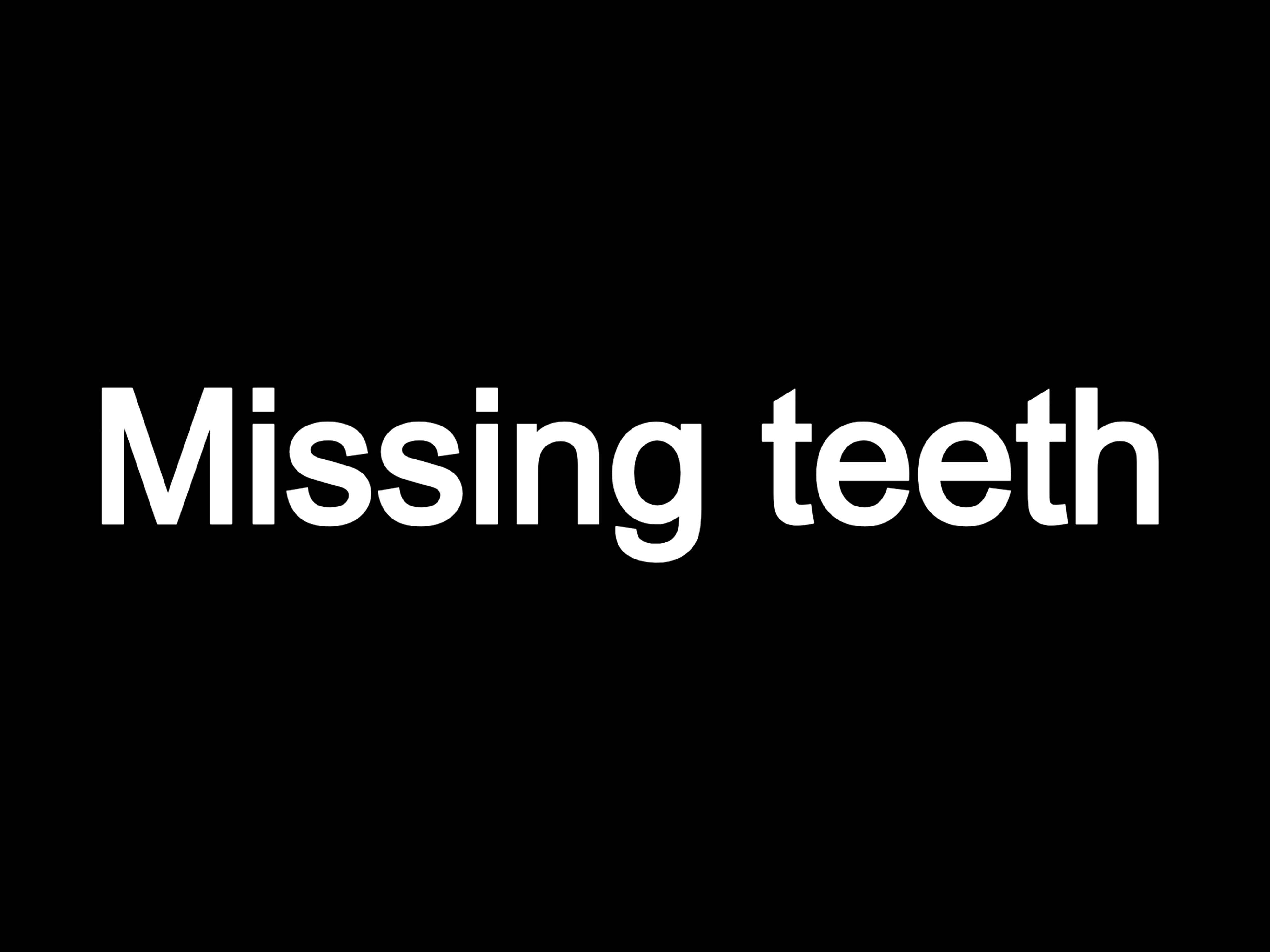 Missing teeth